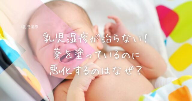 乳児湿疹が治らない！薬を塗っているのに悪化するのはなぜ？